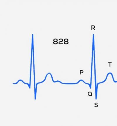 Guide: HRV-målinger og løpetrening – Når er jeg klar for hard trening?
